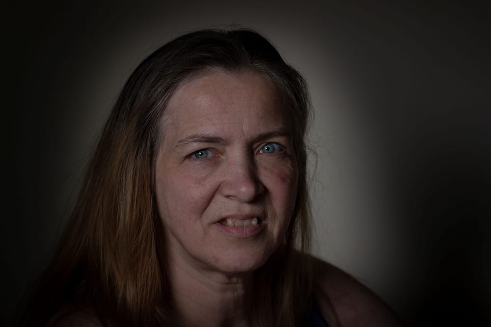 Those dots look like digital toilet paper on my face - image 1 - student project
