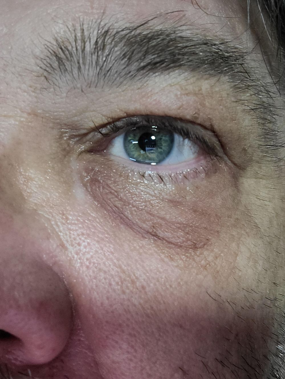My eye - image 1 - student project