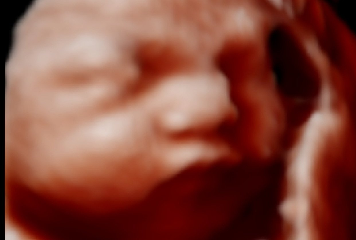 3D 4D ultrasound, How does it work? Skillshare Student Project