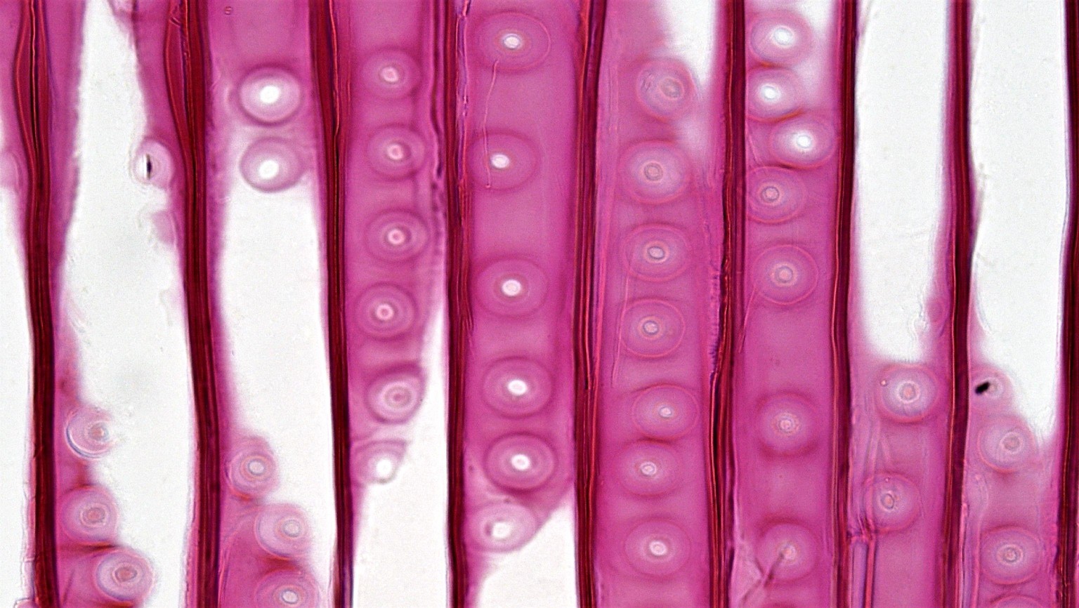 Microscopic patterns - image 6 - student project