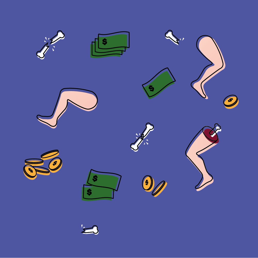 It costs an arm and a leg - image 4 - student project