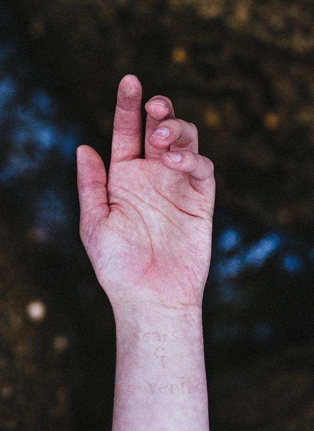 Scars and Souvenirs - image 1 - student project