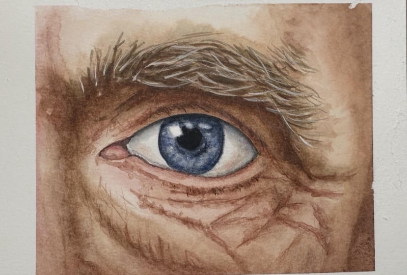 Aged skin and eyes