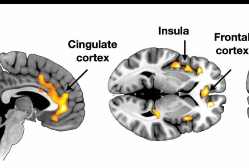 The ability of psychopaths to feel emotions when they are hurt: implications for