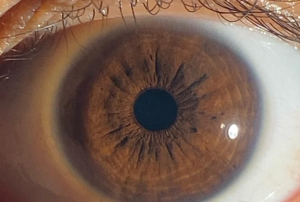 The Eye of human and the face of AI