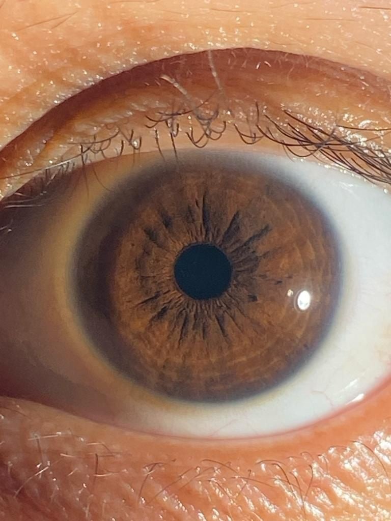 The Eye of human and the face of AI