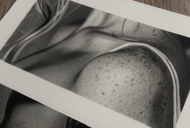 3 Shoulder & Neck Studies