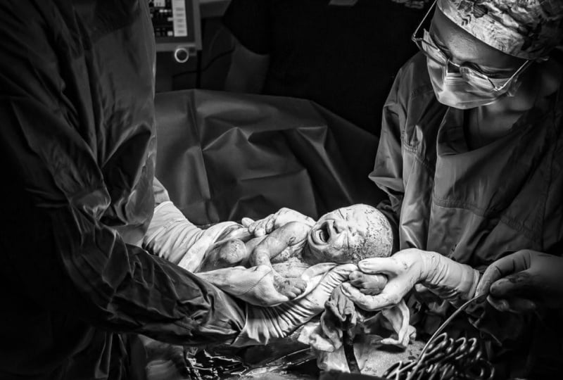 Harsh light in operating theatre