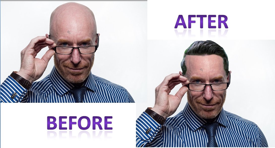 How to Grow Hair on Bald head in Change hair style with